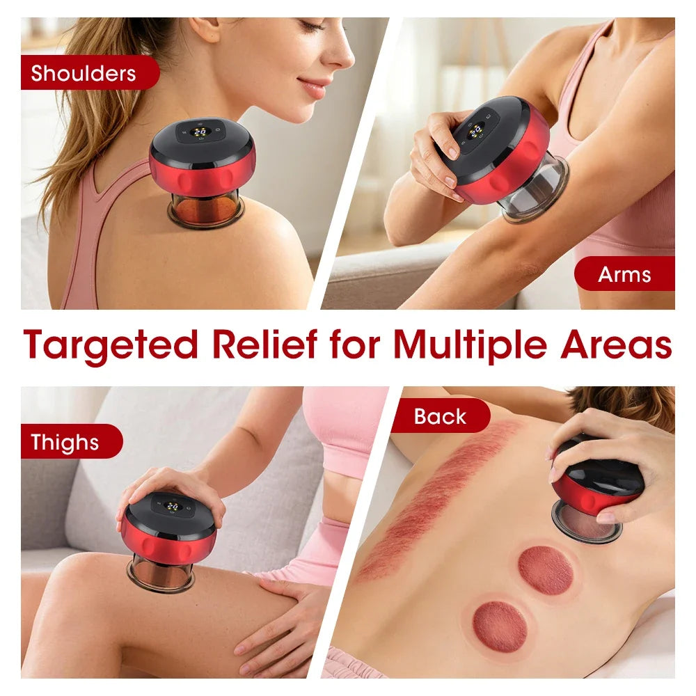Smart Electric Cupping Massager With Red Light Heating And 12 Levels Suction
